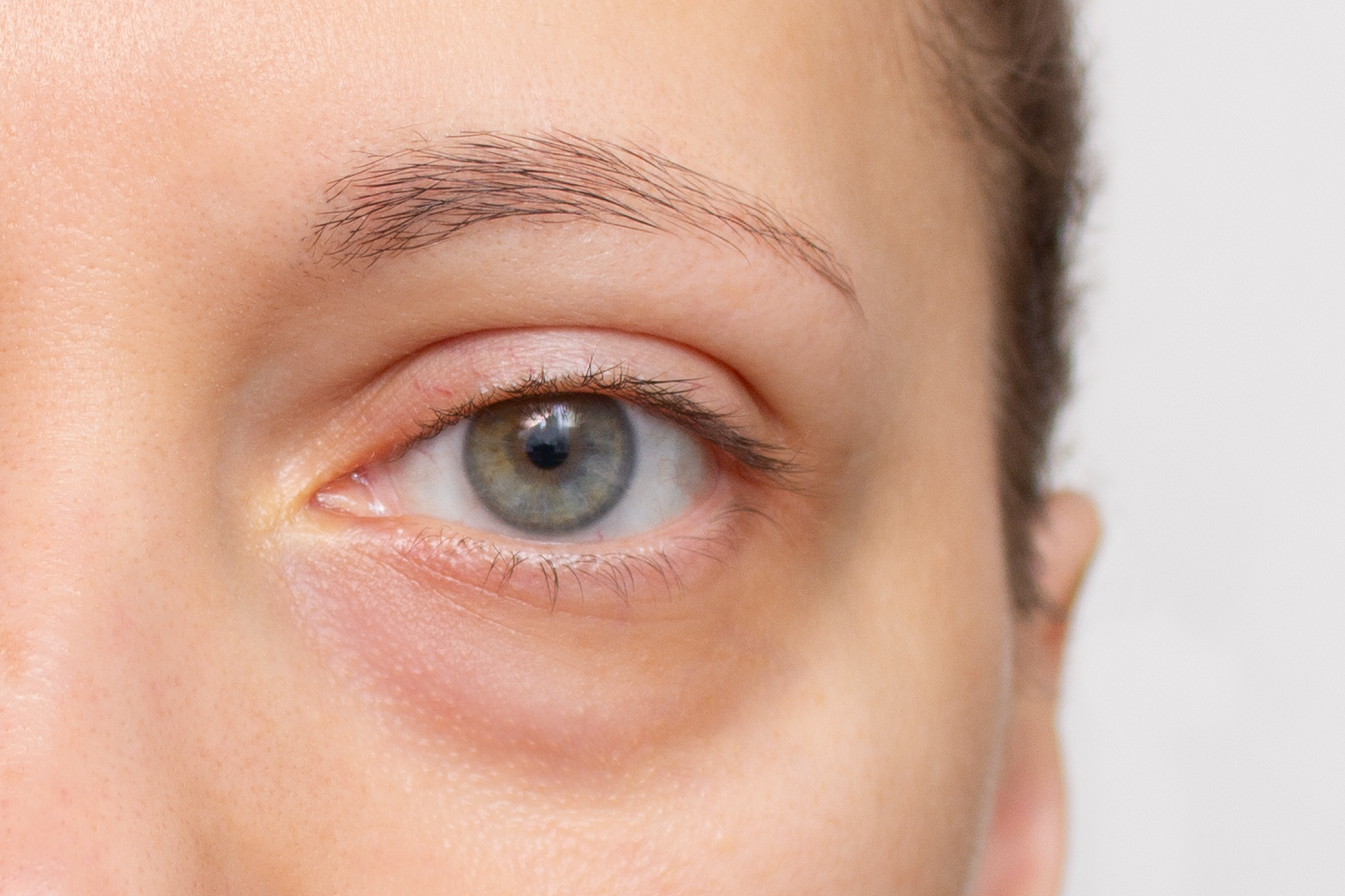 A beauty fan shared a makeup technique that covered up her dark circles (stock photo)