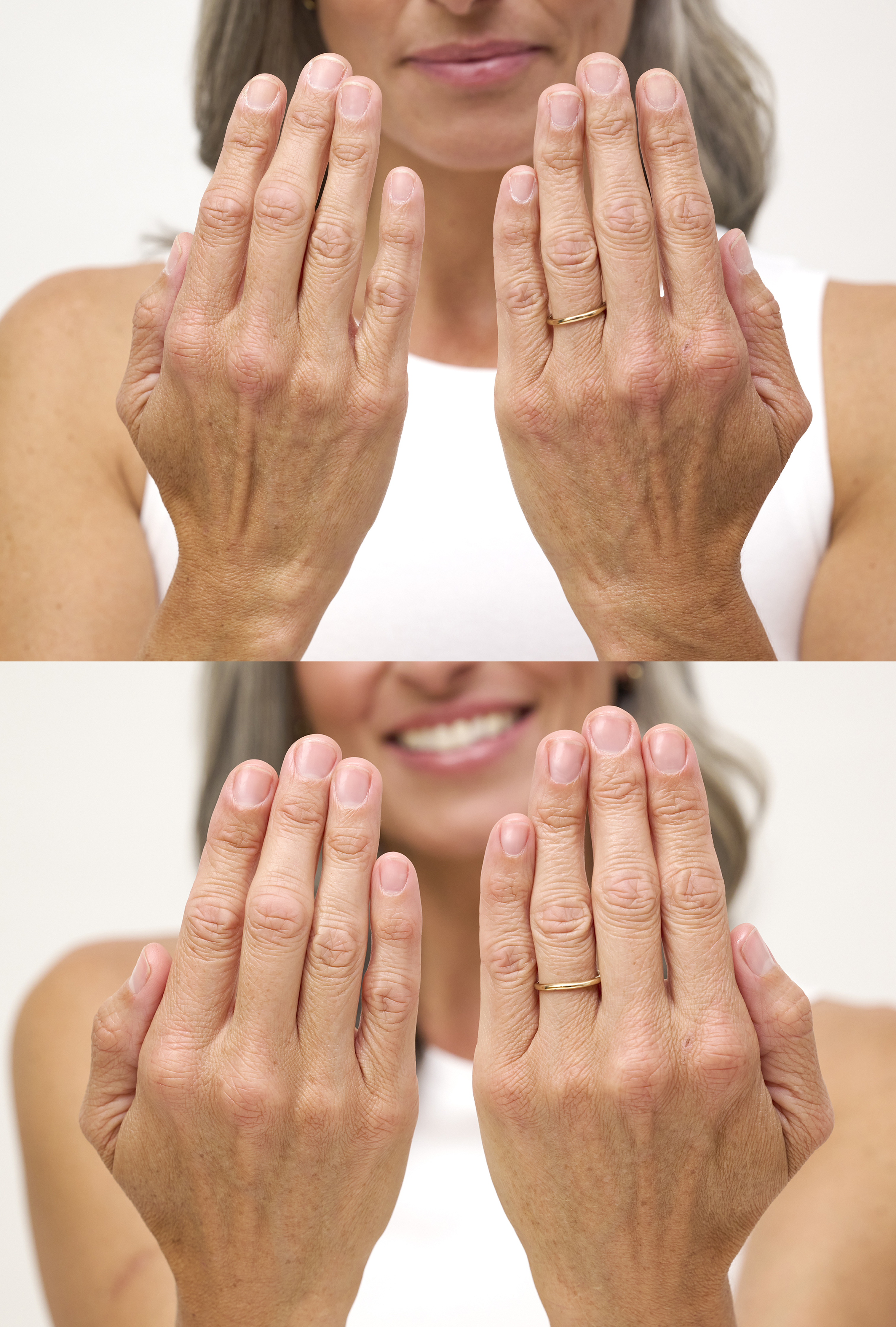 Some before and after photos show how her tips help patients perfect their nail routine