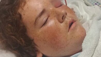 13-year-old Texas boy with plastic pipe sticking out of his head after swimming with friends caused illness that could have killed him