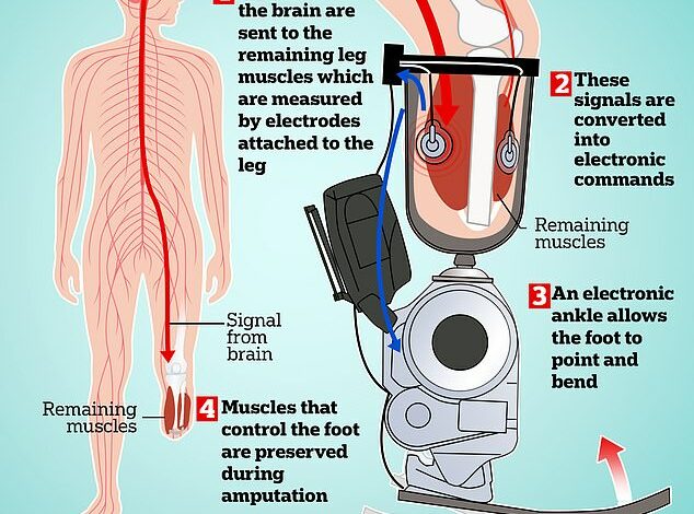 Incredible bionic leg is controlled by human thoughts – and makes it easier for amputees to climb stairs