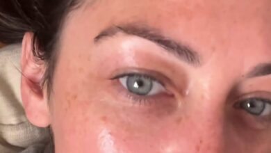 I’m 36 and I erased all my eye wrinkles in just a month with the help of an Amazon purchase