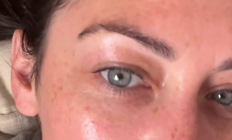 I’m 36 and I erased all my eye wrinkles in just a month with the help of an Amazon purchase