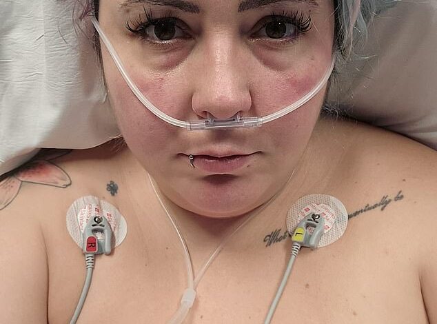 33-year-old London woman nearly died after £4.5k gastric balloon got ‘stuck’ in her intestines