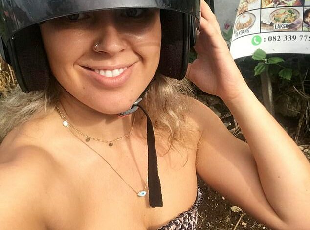 I nearly lost my foot after it was pierced by a metal moped stand in a horrific accident in Bali: 28-year-old British tourist warns tourists not to wear flip-flops on motorbikes after she suffered a horrific infection when she hit a pothole