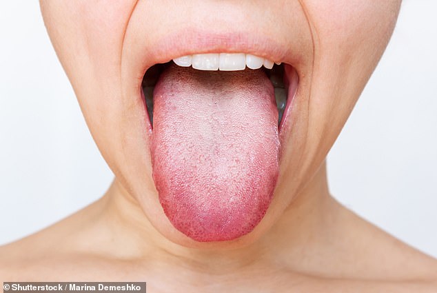 DR. ELLIE Reveals What a White, Hairy Tongue Really Means for Your Health