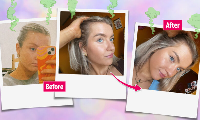 I tried a 10p trick to cure my hair loss – it smelled so bad and my scalp was on fire