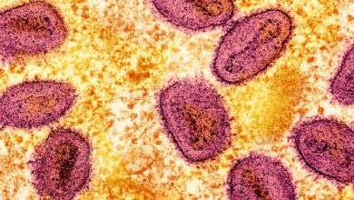 New Mpox strain discovered in Sweden, first case outside Africa