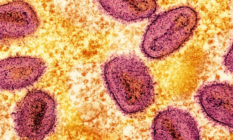 New Mpox strain discovered in Sweden, first case outside Africa