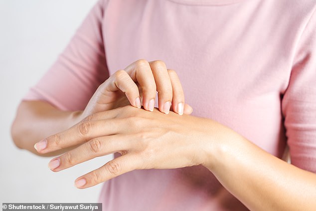 Relief for people with hand eczema as regulator close to approving first drug