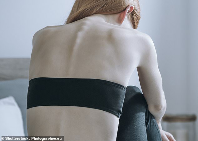 Right to die ‘granted to people with eating disorders’, shocking report claims – and ‘at least 60 people have taken their own lives in the last decade’