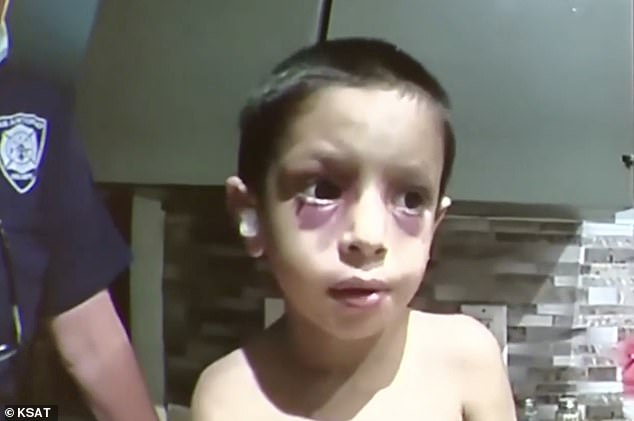 Harrowing moment police visited four-year-old boy with black eyes and protruding bones, weeks before he starved to death