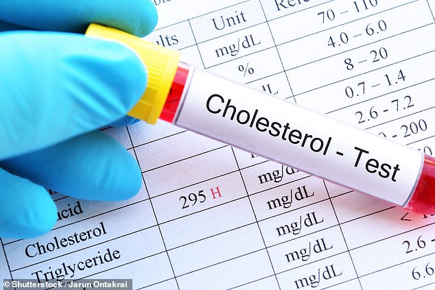 DR. MARTIN SCURR: Secret signs I use to detect patients with high cholesterol