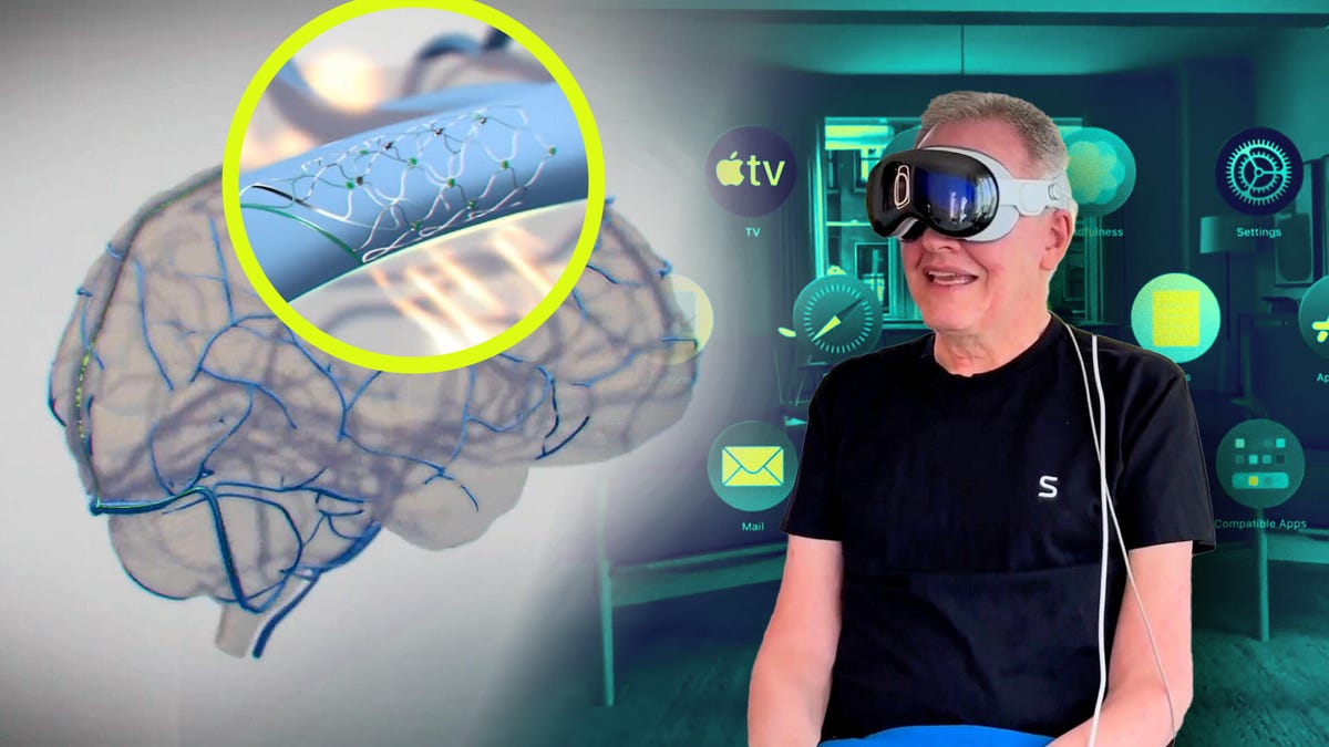 First use of Brain Implant with Apple Vision Pro, Amazon Alexa – Video