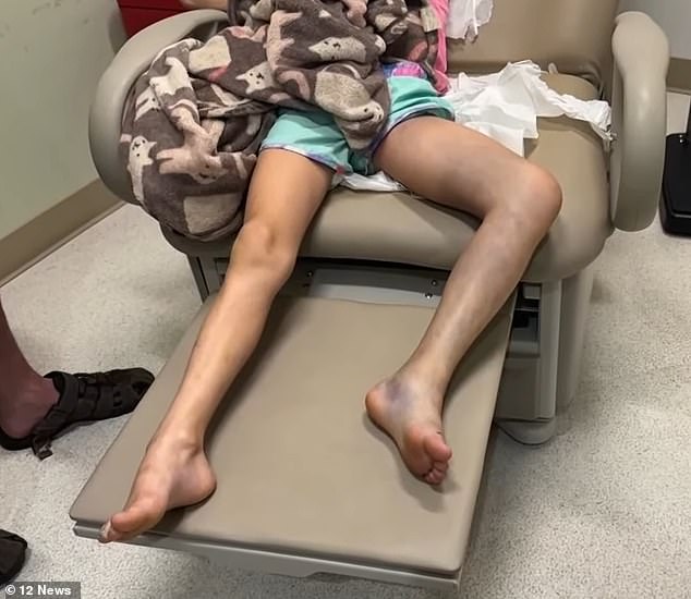 Girl is taken to emergency room when ‘sprained ankle’ turns purple… Doctors have found something much more sinister