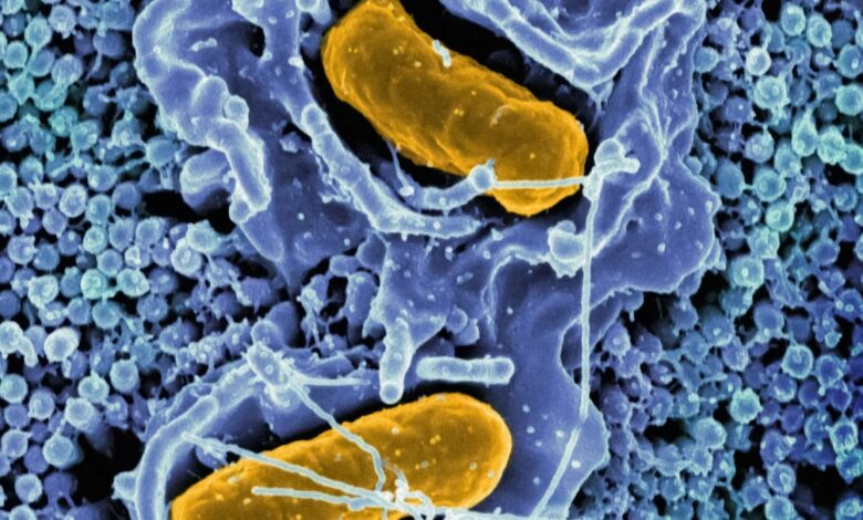 Human immune system may have evolved from ancient microbe ‘Asgard’