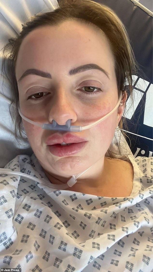 Mother-of-two left to fight for life after liposuction in Turkey led to ‘flesh-eating’ disease and fatal blood poisoning