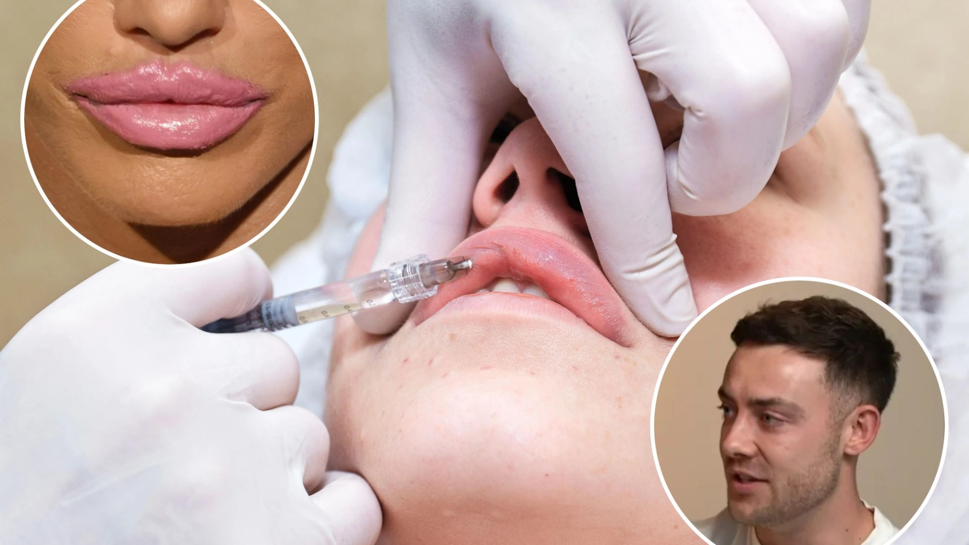 Doctors warn of shocking lip filler trend that could make you look ‘horrific’