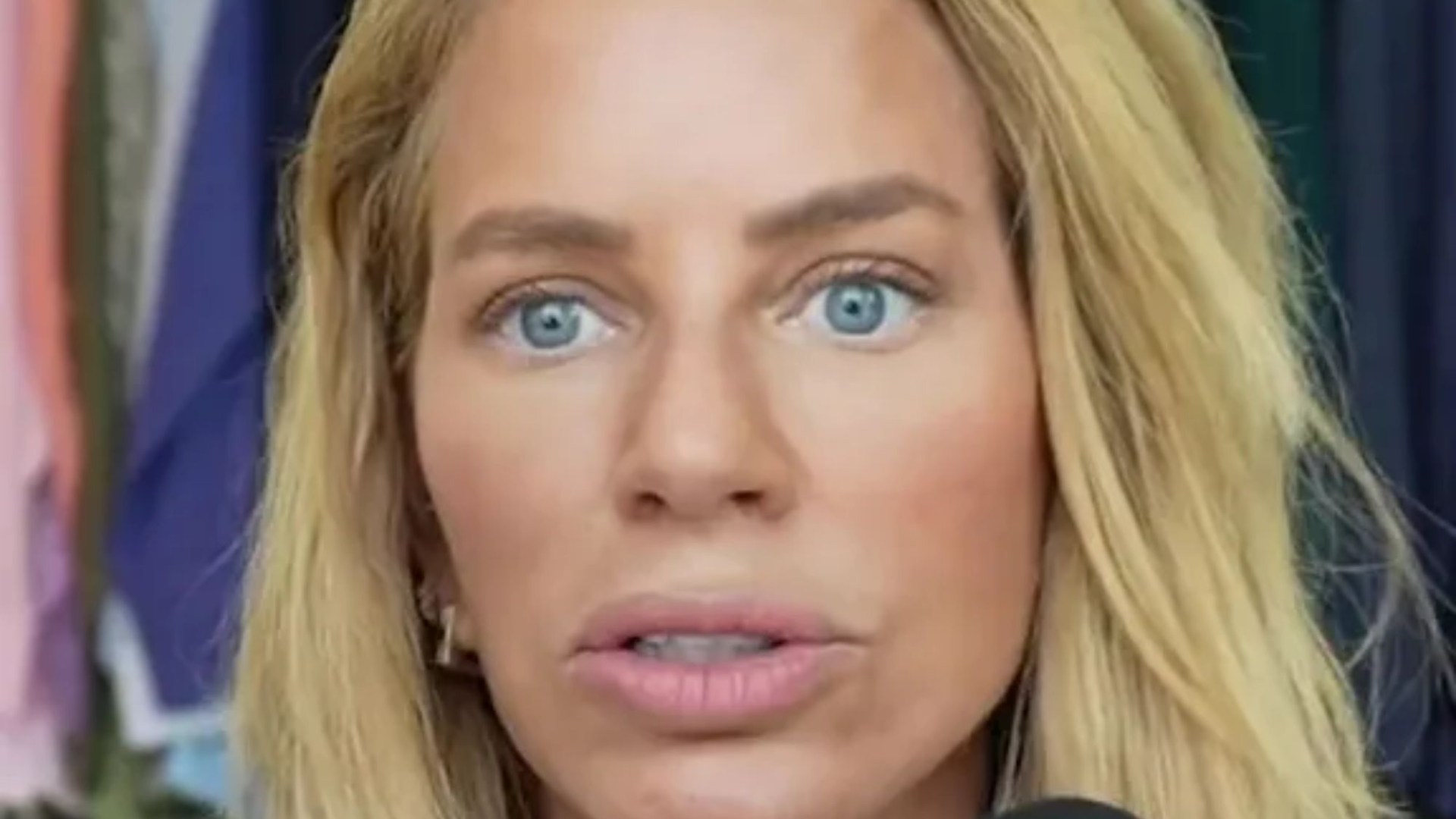 I got a facelift in my 40s like Katie Price, but trolls say I look worse