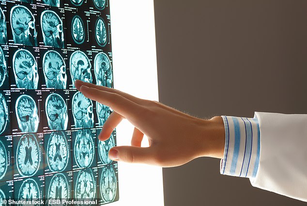 Major breakthrough for Alzheimer’s as experts discover ‘double whammy’ drug that destroys memory-robbing brain proteins