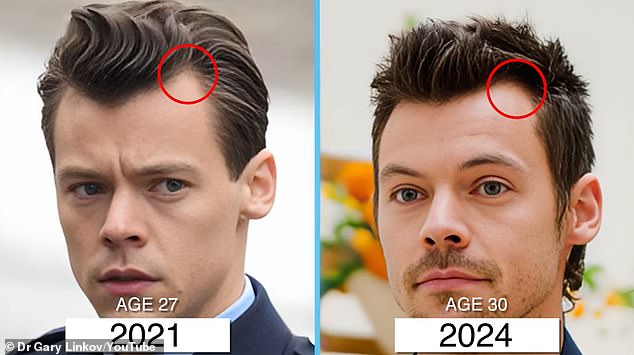 Plastic surgeon reveals how he thinks Harry Styles brought his famous hairline back from the dead