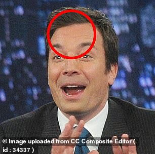 Plastic surgeons reveal why Jimmy Fallon’s face never ages