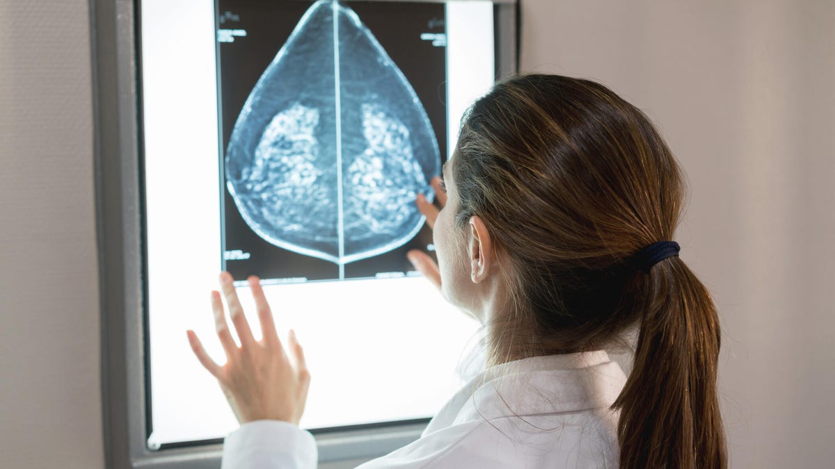 What is breast density and why do you need to know yours?