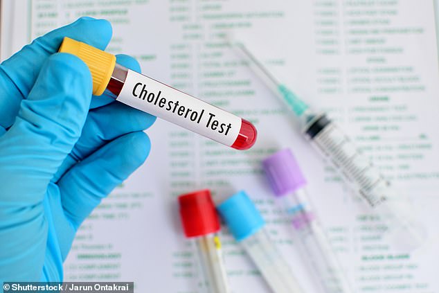 A five-minute cholesterol check could reveal whether dementia will strike in six years, experts say