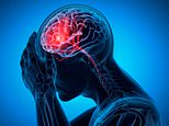 A neurologist reveals how to tell if your headache is a sign of a deadly brain tumor or just a bad cold