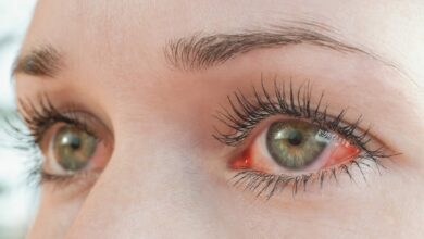 Dry, itchy eyes? Try these 7 home remedies to soothe your eyes