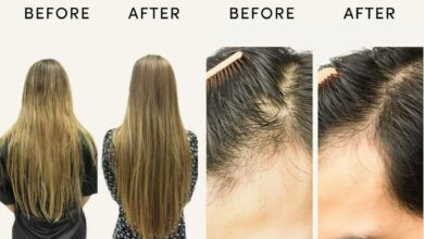 ‘Game changer!’ satisfied customers rave about the Amazon purchase that reduces hair loss