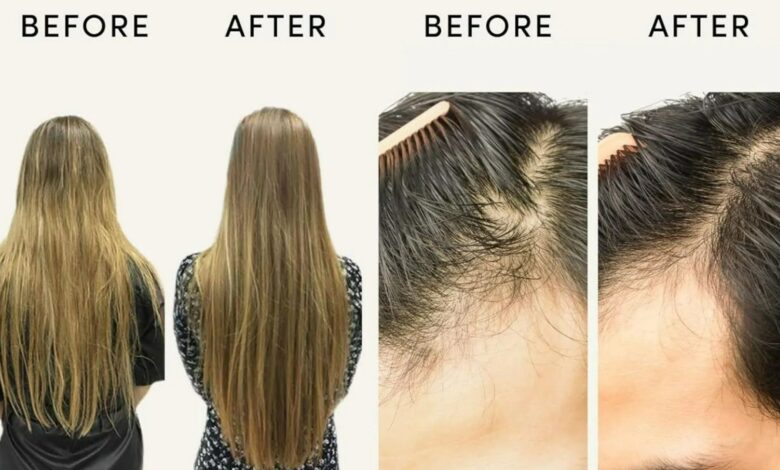 ‘Game changer!’ satisfied customers rave about the Amazon purchase that reduces hair loss