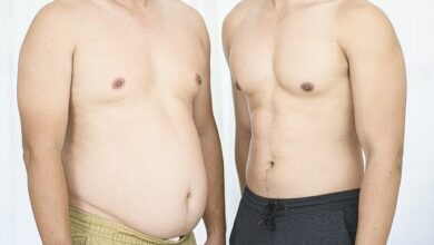 How fat ‘memory’ in cells can be a cause of yo-yo dieting