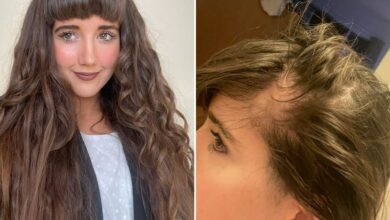 I prevented my hair from falling out with a £15 purchase, but there’s a viral hack you can avoid