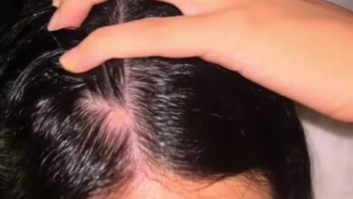 I’m 23, but I had a huge bald spot on my head. A £19 oil made my locks grow back