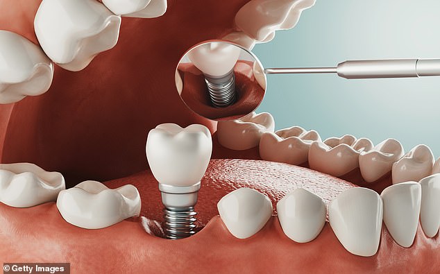 Officials warn THOUSANDS have been hit by new dental scams