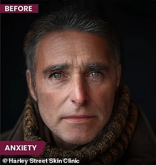 Startling photos show how anxiety and habitual habits age your skin