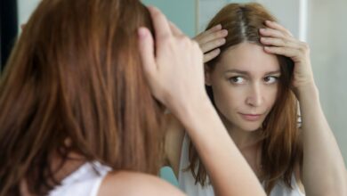 I’m a hair expert: the Christmas treats to avoid if you don’t want dandruff